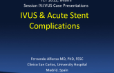 IVUS and Acute Stent Complications