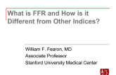 What Is FFR, and How Is It Different from Other Indices?