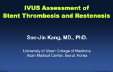 IVUS Assessment of Stent Thrombosis and Restenosis