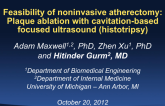 TCT-114: Feasibility of Noninvasive Atherectomy: Plaque Ablation with Cavitation-Based Focused Ultrasound (Histotripsy)