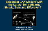 Epicardial LAA Closure with the LARIAT (SentreHEART): Simple, Safe, and Effective?