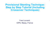 Provisional Stenting Technique: Step by Step Tutorial (Including Crossover Techniques)
