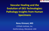 Vascular Healing and the Evolution of DES Technologies: Pathology Insights from Human Specimens