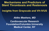 Mechanisms and Predictors of Stent Thrombosis and Restenosis: Insights from Grayscale and VH-IVUS
