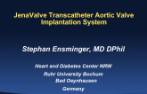 JenaValve TAVR System