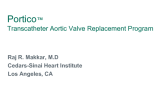 St. Jude Medical Portico TAVR System