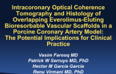 TCT-33. Intracoronary Optical Coherence Tomography and Histology of Overlapping Everolimus-Eluting Bioresorbable Vascular Scaffolds in a Porcine Coronary Artery Model: The...