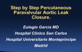 Percutaneous Closure of an Aortic Paravalvular Leak: Step by Step Case