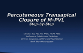 Step-by-Step Case: Closure of Mitral Paravalvular Leak: Transapical Approach