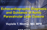 Echocardiographic Diagnosis and Guidance of Aortic Paravalvular Leak Closure