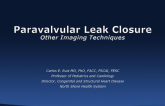 Other Imaging Techniques for Paravalvular Leaks
