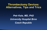 Thrombectomy Devices: Alternatives, Tips and Tricks