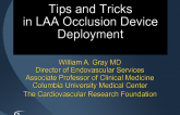 Tips and Tricks in LAA Deployment