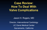 Case Review 4: How to Deal with Valve Complications