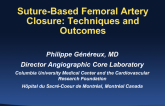 Percutaneous Femoral Artery Closure During TAVR