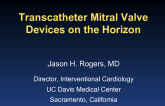 Transcatheter Mitral Valve Devices on the Horizon