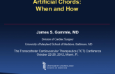 Artificial Chords: When and How?