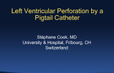 Left Ventricular Perforation by a Pigtail Catheter