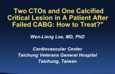 Multiple CTOs and a Calcified Critical Lesion After Failed CABG