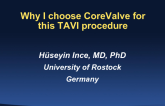 Why I Chose CoreValve for This TAVI Procedure