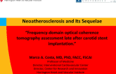 Case Presentation 1: Neoatherosclerosis and Its Sequelae