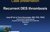 Case Presentation (with Discussion): Recurrent DES Thrombosis