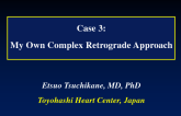Case 3: My Own Complex Retrograde Approach