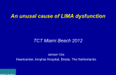 An Unusual Cause of LIMA Dysfunction