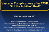 Frequency, Predictors, and Consequences of Major Vascular Complications After TAVR