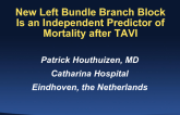 New Left Bundle Branch Block Is an Independent Predictor of Mortality After TAVR