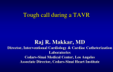 Tough Call During a TAVR
