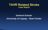 Case 4: TAVR-Related Stroke
