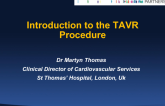 Introduction to the TAVR Procedure