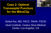 Case 2: Optimal Transseptal Puncture for the MitraClip
