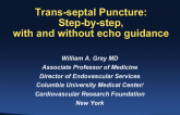 Transseptal Puncture: Step by Step, With and Without Echo Guidance