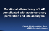 Late Complication After Rotational Atherectomy