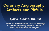 Coronary Angiography II: Artifacts and Pitfalls