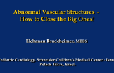 Abnormal Vascular Structures - How to Close the Big Ones!