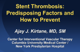 Stent Thrombosis: Predisposing Factors and How to Prevent
