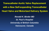 Transcatheter Aortic Valve Replacement with a New Self-expanding Percutaneous Heart Valve and Motorized Delivery System