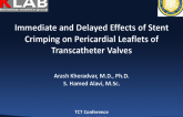 Immediate and Delayed Effects of Stent Crimping on Pericardial Leaflets of Transcatheter Valves