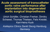 Acute assessment of transcatheter aortic valve performance after implantation into degenerated aortic surgical bioprostheses