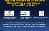 Reaching Further in the Treatment of Calcified Small Vessel Disease - is Rota-DEB an Option?