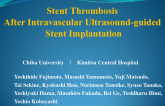 Stent Thrombosis After Intravascular Ultrasound-guided Stent Implantation