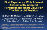 First Experience With A Novel Anatomically Adapted Percutaneous Heart Valve For The Tricuspid Position