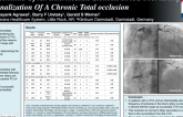 Evaluating Ischemia Of An Intermediate Stenosis In A Donor Artery During Recanalization Of A Chronic Total Occlusion