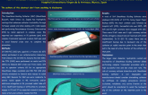 Sheathless Guide Catheters in complex Transradial PCI. A Single Center Experience