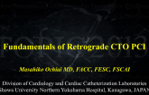 Fundamentals of Retrograde CTO PCI: The Basic Step-by-Step Approach