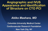 Angiographic and IVUS Appearance and Identification of Structures on CTO PCI