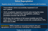 TAVR for Pure Severe Native Aortic Valve Regurgitation